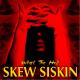 Skew Siskin - Jesse James