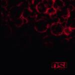 album image The Escape Artist Blood